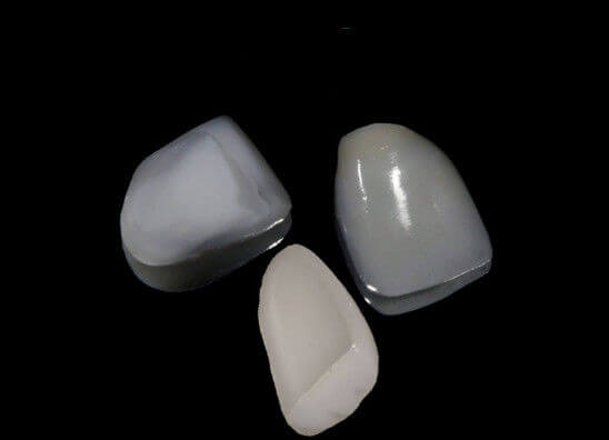 Why Is Porcelain Veneers Essential For Improving The Glow Of The Smile?