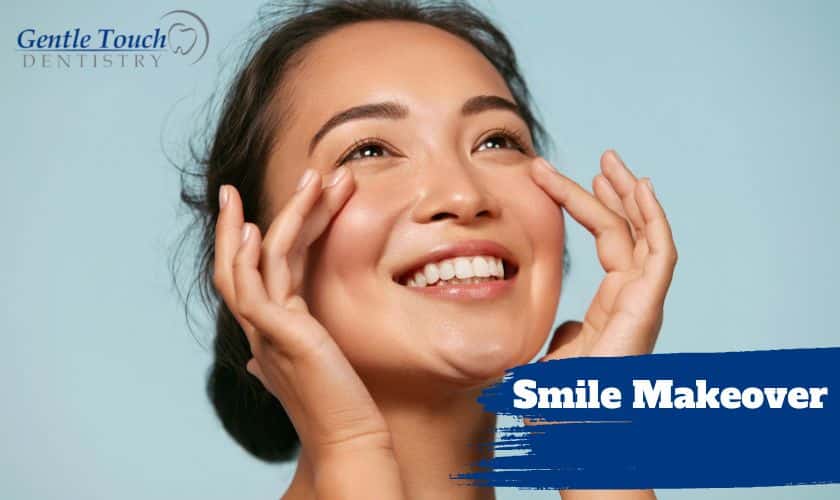 Smile Makeover: Things You Must Consider Before Heading for the Treatment