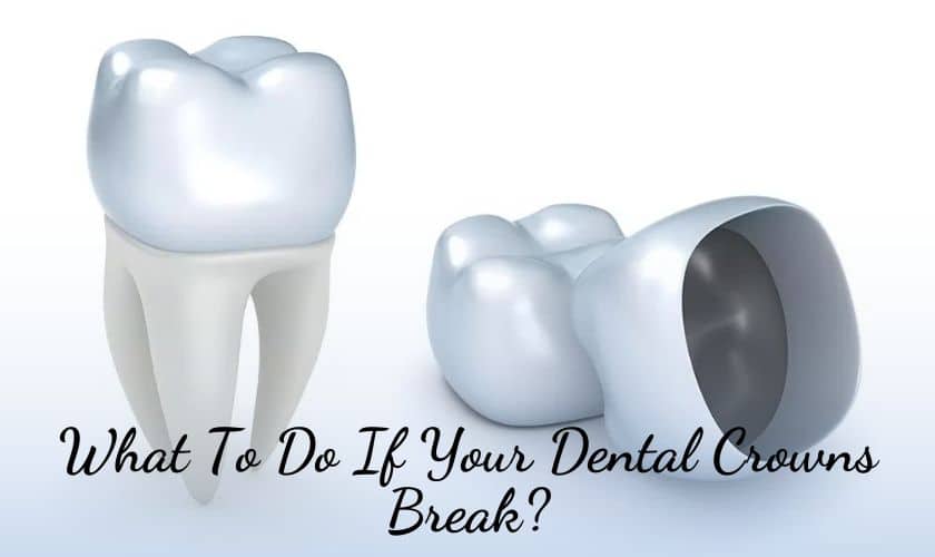 What To Do If Your Dental Crowns Break?