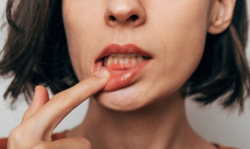 Tips to Avoid Gum Disease