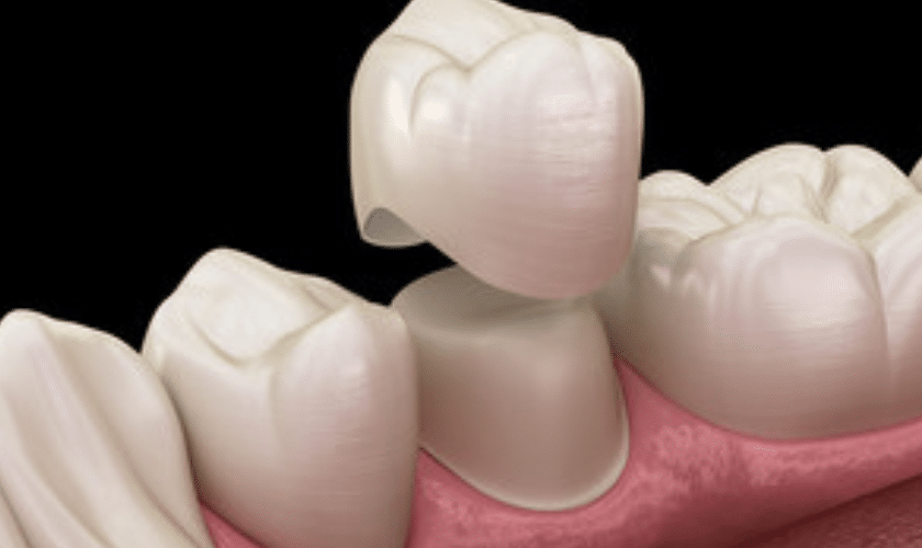 Signs You're The Right Candidate For Dental Crowns