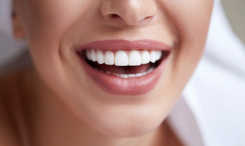 Teeth Whitening Care
