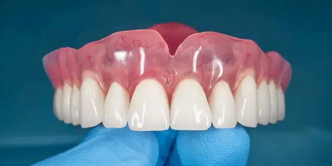 Dentures in Richardson, TX, Gentle Touch Dentistry Richardson