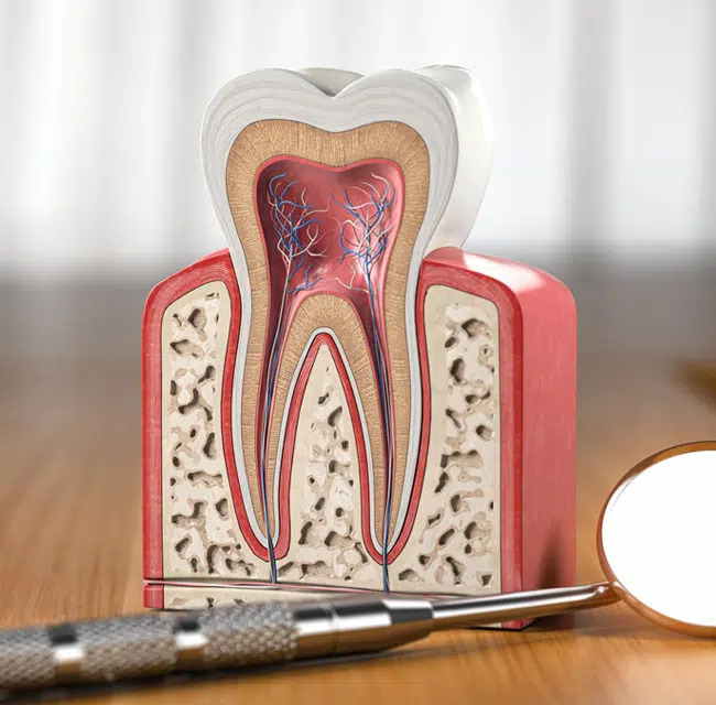 Root Canal Therapy in Richardson, TX, Gentle Touch Dentistry Richardson