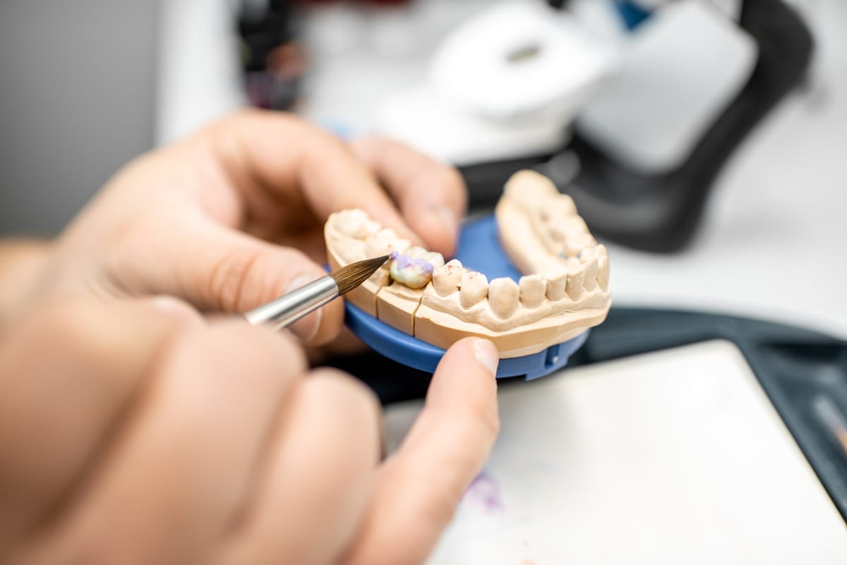 Dental Crowns in Richardson